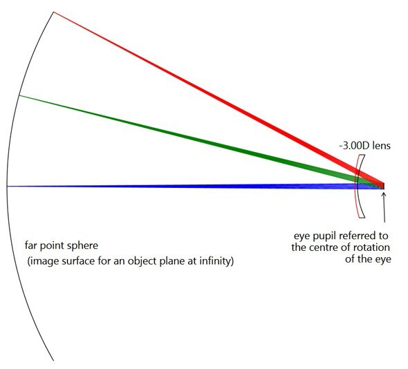 Ansys Zemax | 眼科镜片设计的图1