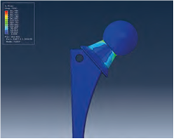 Moldex3D模流分析之案例分享：Moldex3D 提供医疗器材产品模流解决方案的图5