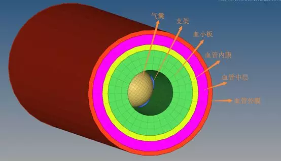 血管支架强度/刚度有限元仿真-（1）的图12