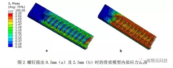 有限元法在椎弓根钉强度中的应用的图3