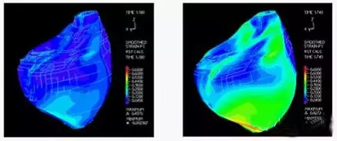 仿真技术在生物医学领域的应用的图14