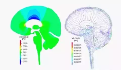 仿真技术在生物医学领域的应用的图13