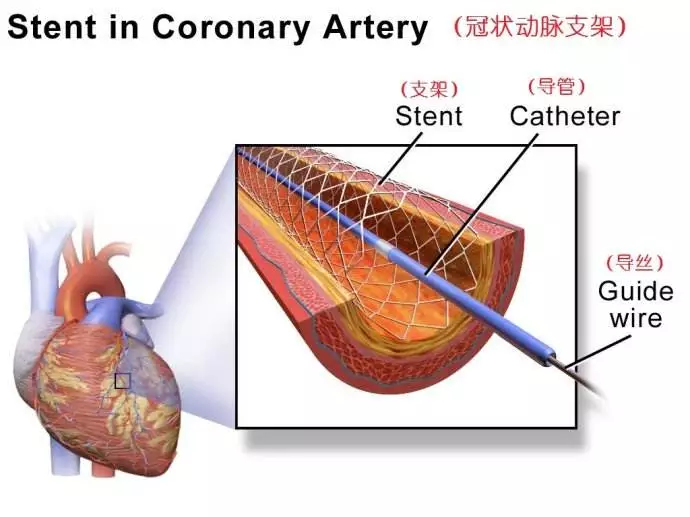 仿真技术在生物医学领域的应用的图11