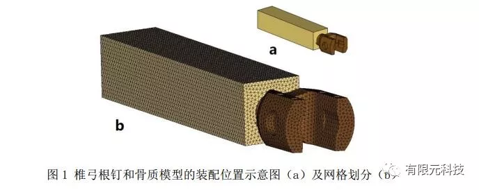 有限元法在椎弓根钉强度中的应用的图2