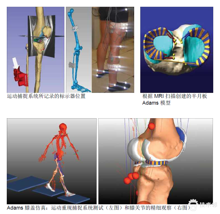 案例分析：密苏里大学-Adams 仿真帮助诊断膝盖病的图3