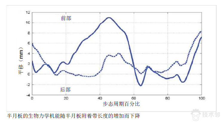 案例分析：密苏里大学-Adams 仿真帮助诊断膝盖病的图4