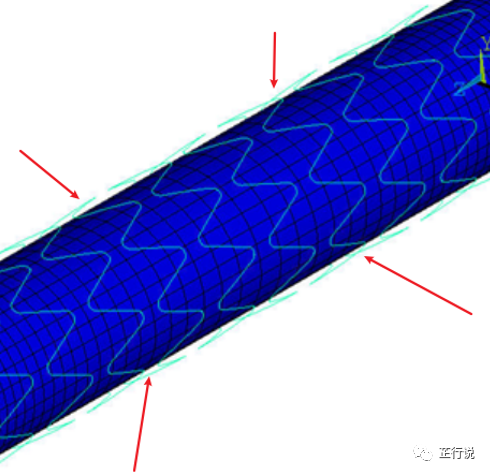 心血管支架移植模拟分析（ANSYS_APDL命令流）的图11