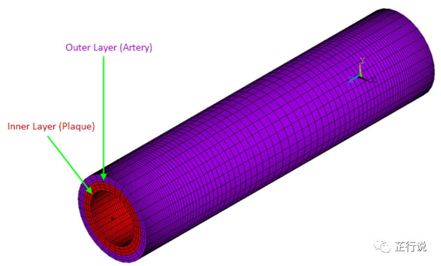 心血管支架移植模拟分析（ANSYS_APDL命令流）的图9