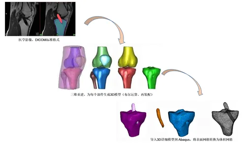 干货分享 | 基于ABAQUS的前十字韧带（ACL）重建三维数值分析的图3