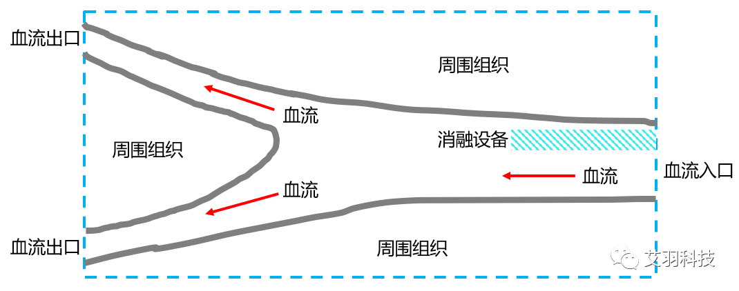 Fluent案例：肾动脉RDN治疗过程的仿真